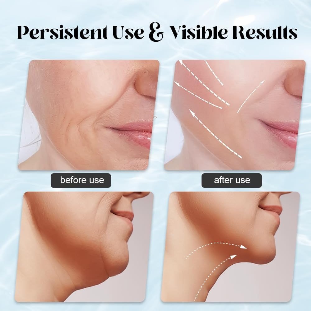 EMS Face Lifting Massager